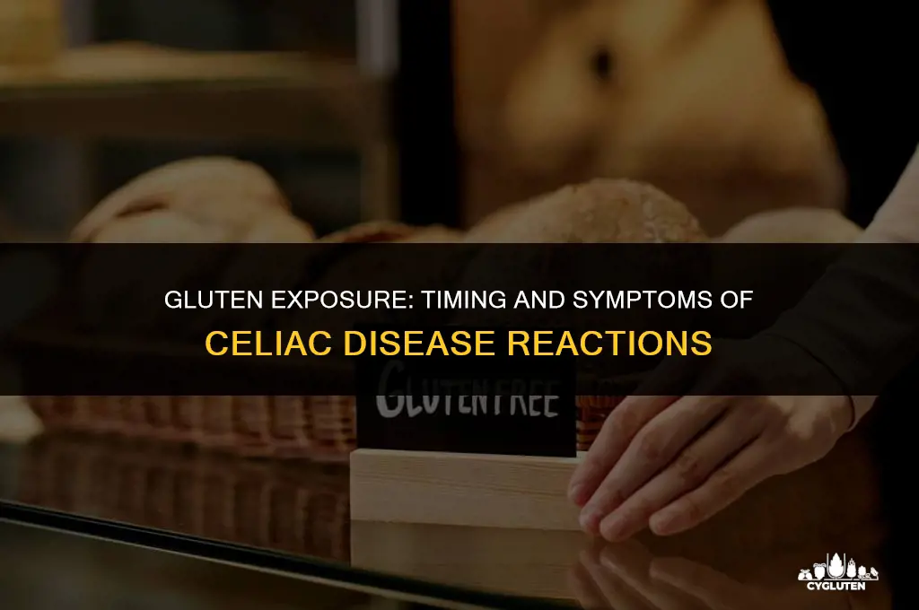 how soon after eating gluten do celiacs get sick