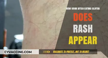Gluten Rash Timeline: When Does Skin React After Consumption?