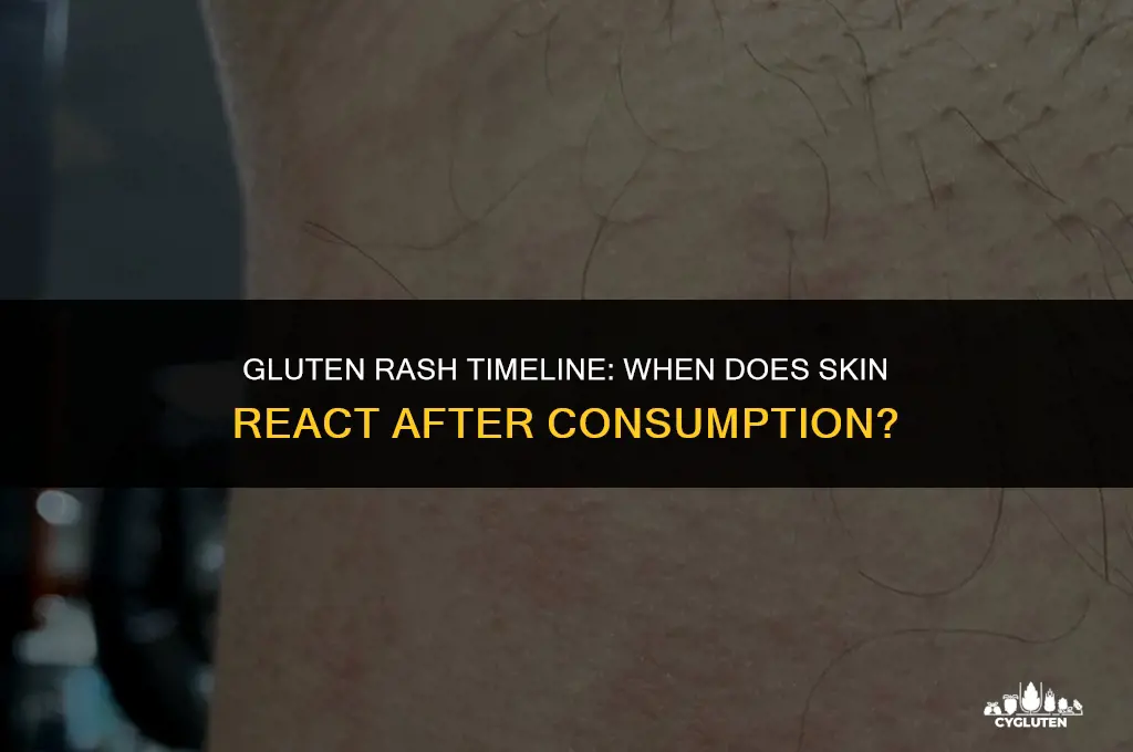 how soon after eating gluten does rash appear