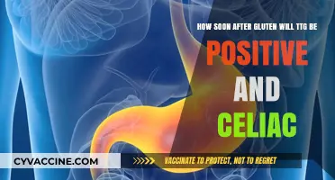 Decoding Celiac: The Gluten-TTG Connection Timeline