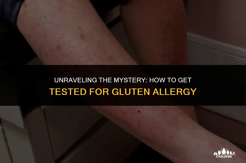 how to be tested for gluten allergy