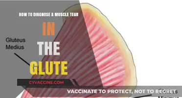 Identifying Glute Muscle Tears: A Comprehensive Guide