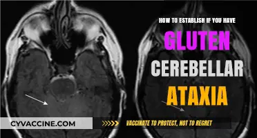 Unraveling Gluten Cerebellar Ataxia: A Guide to Diagnosis