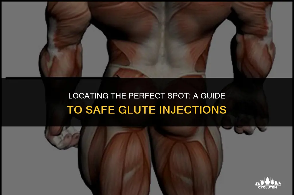 how to find injection site on glute