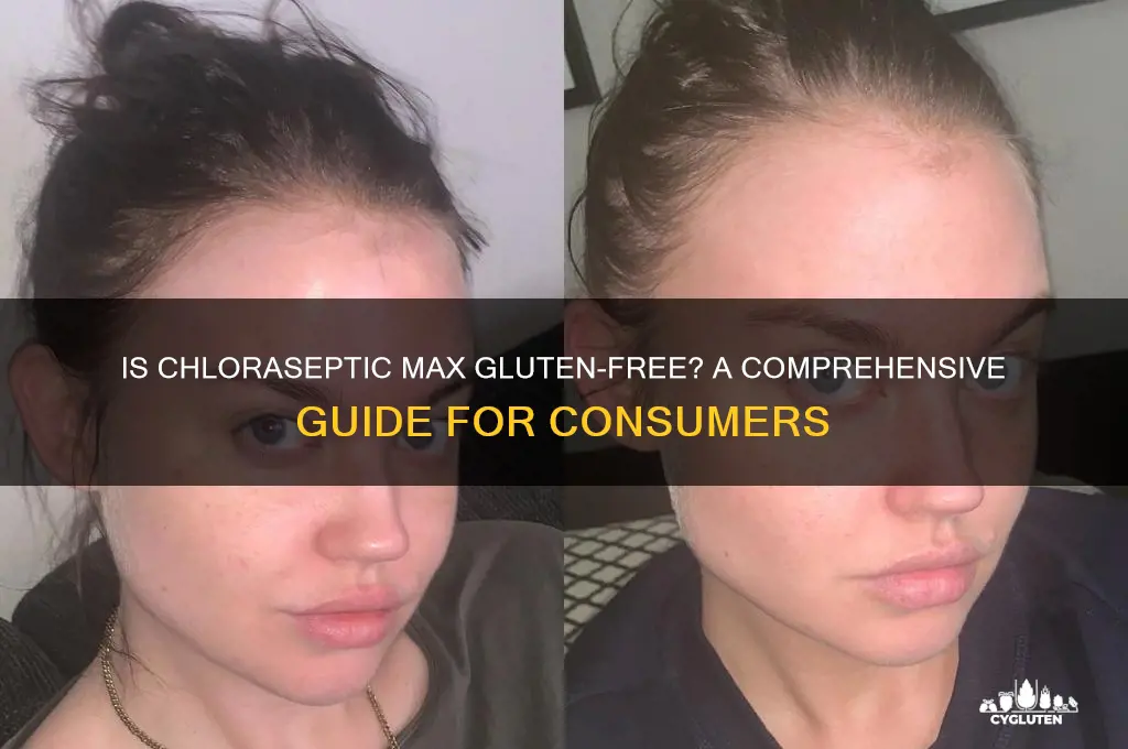 is chloraseptic max gluten free